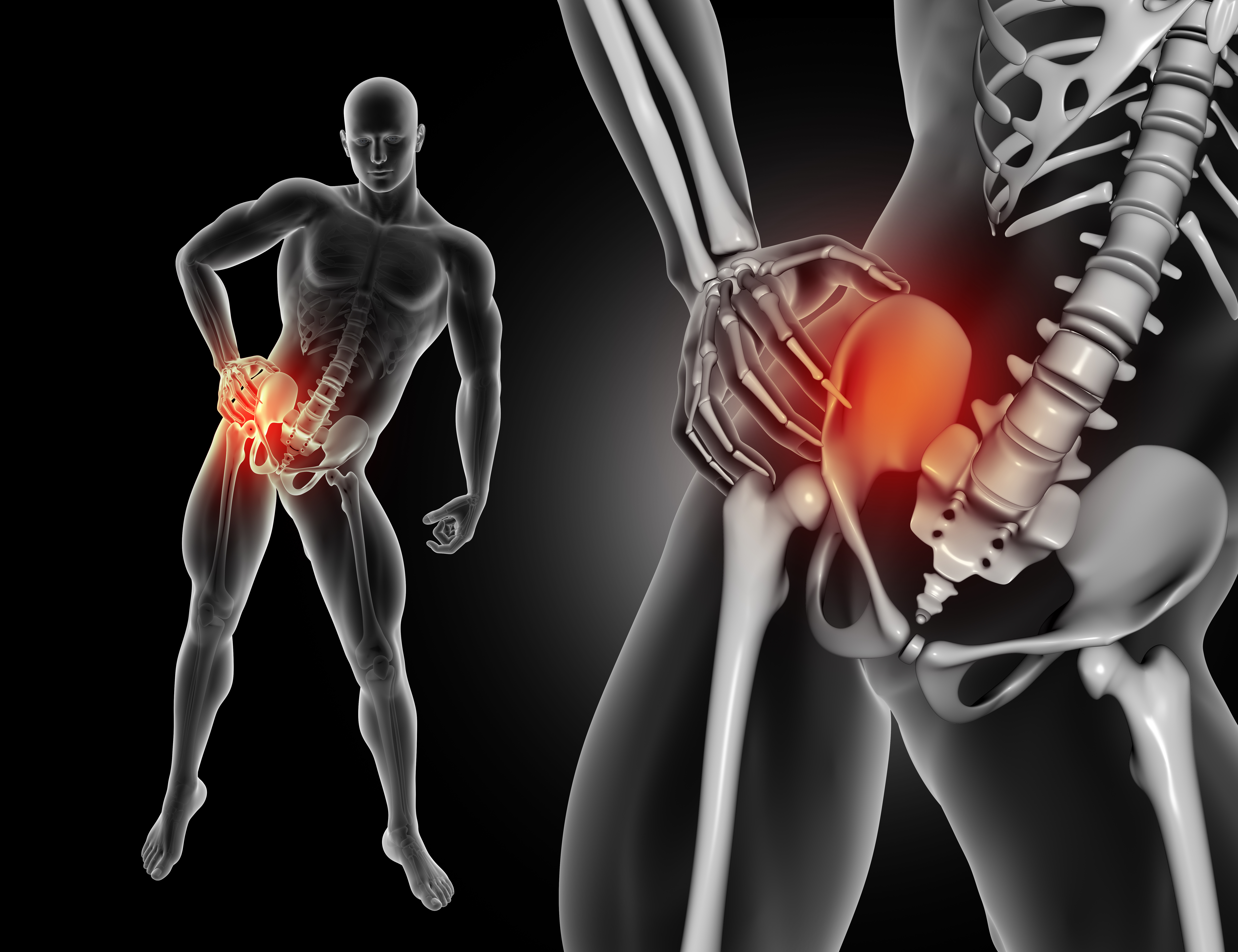 Hip replacement ? Diagnosis And Treatment